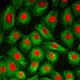 Fluorescent Trinocular Biological Microscope